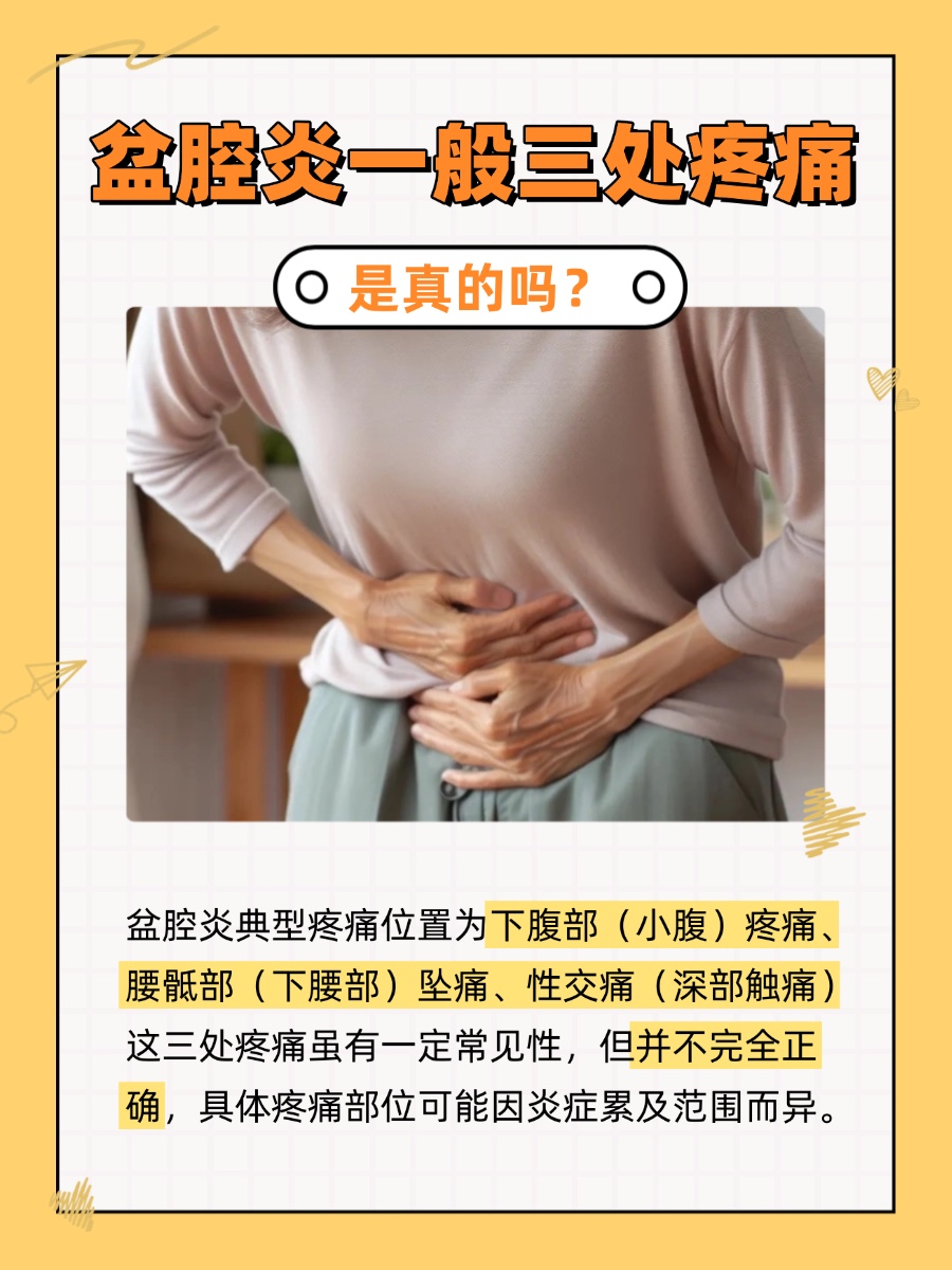 盆腔炎一般三处疼痛，是真的吗？快来对照！