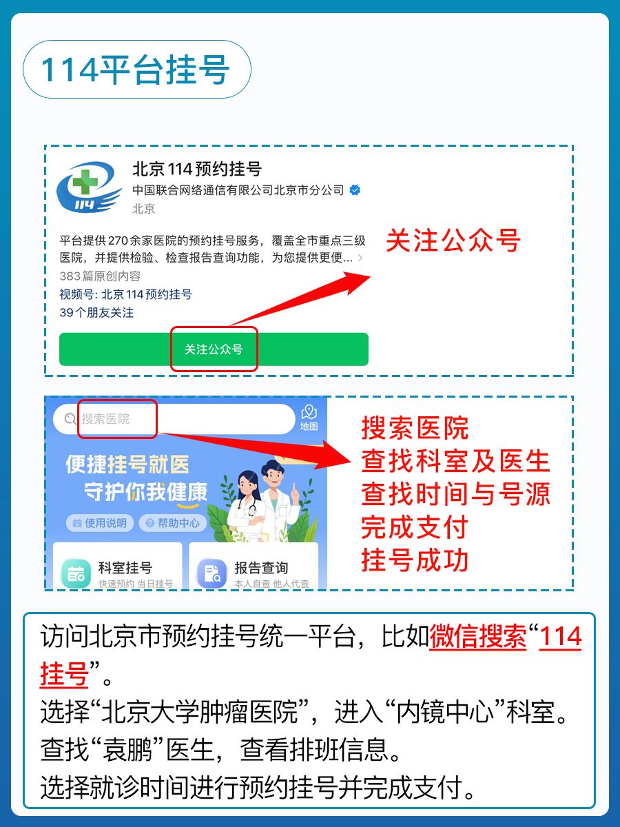 北京大学肿瘤医院袁鹏医生怎么样?怎么挂号?