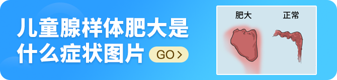 儿童腺样体肥大是什么症状图片