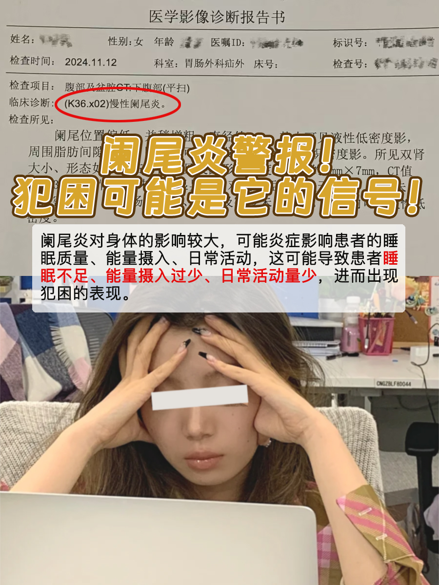阑尾炎警报！犯困可能是它的信号！