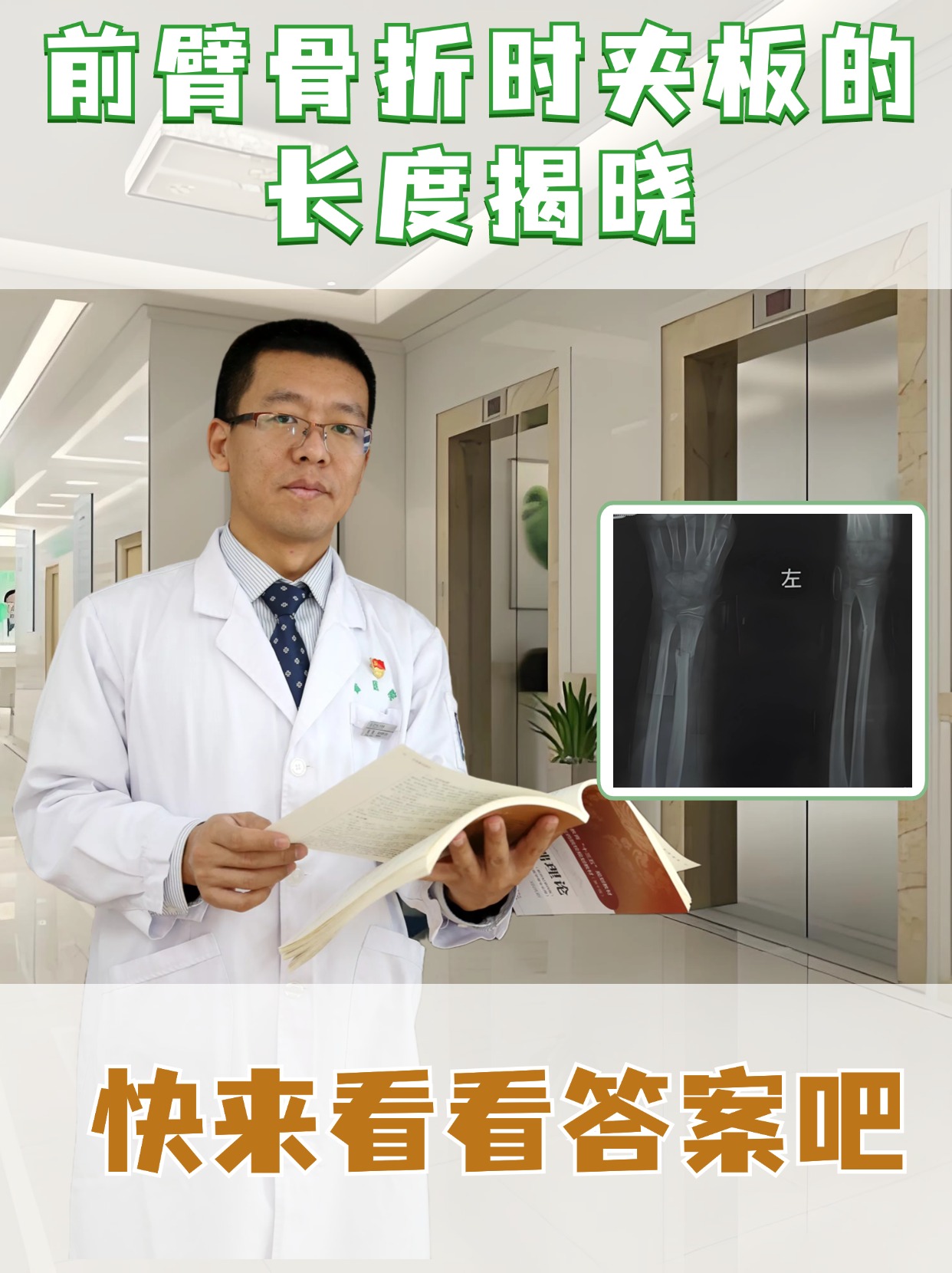 前臂骨折时夹板的长度揭晓，快来看看答案吧