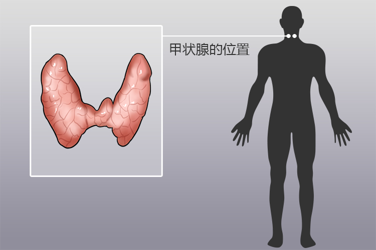 甲状腺疼痛部位图