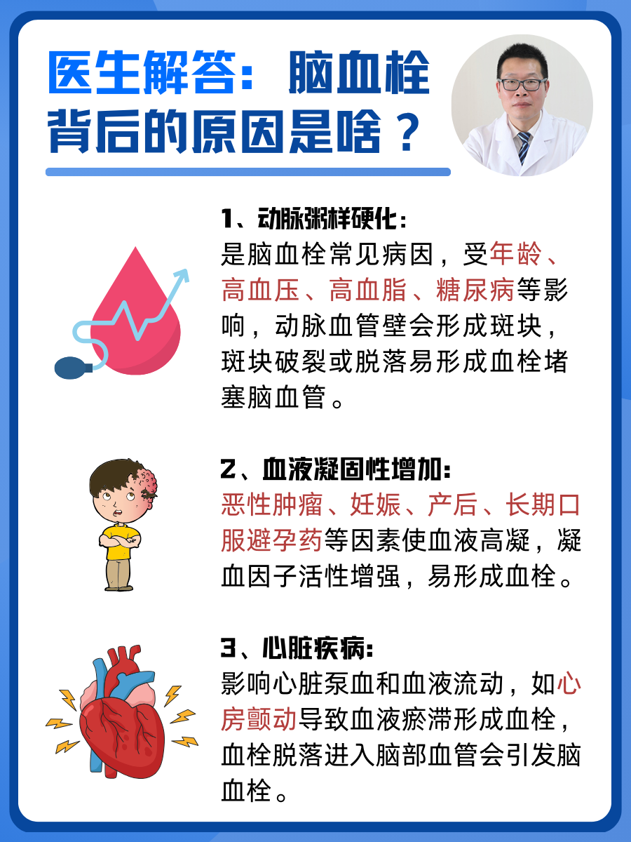 医生解答：脑血栓背后的原因是啥？