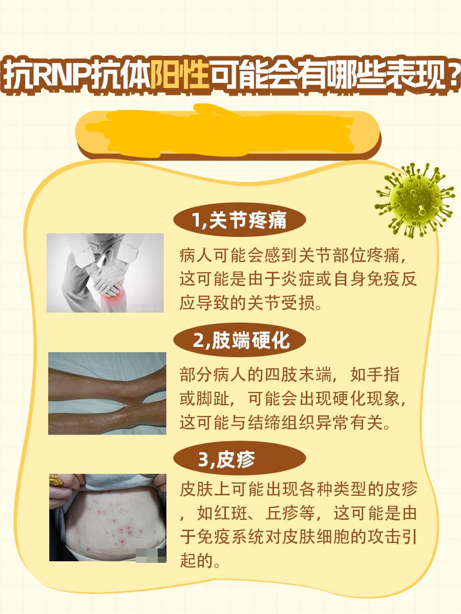 抗RNP抗体阳性：背后的意义