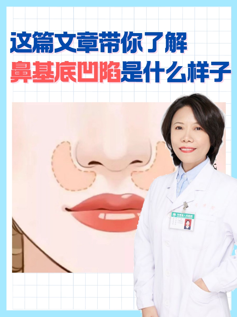 这篇文章带你了解，鼻基底凹陷是什么样子