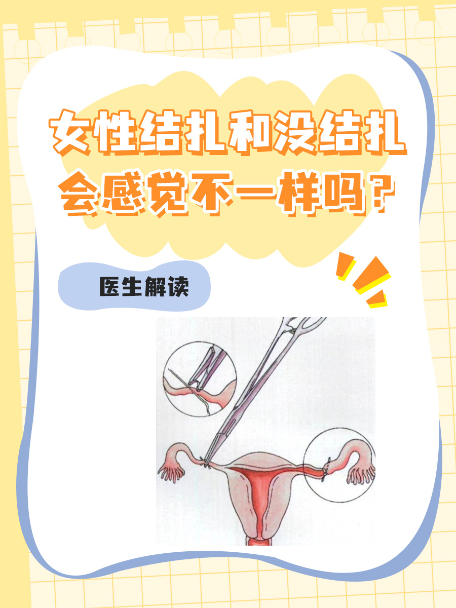 女性结扎和没结扎会感觉不一样吗？医生解读