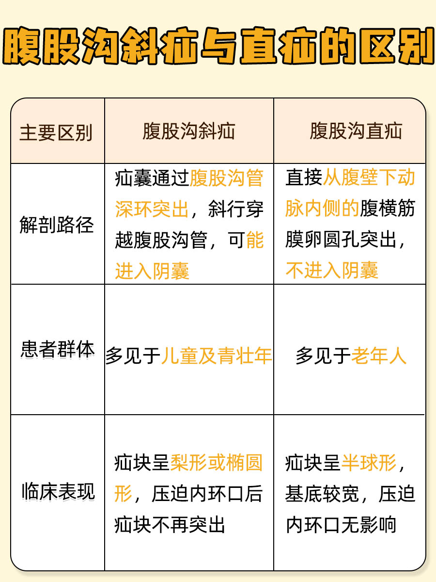 腹股沟斜疝和直疝区别，一文大揭秘