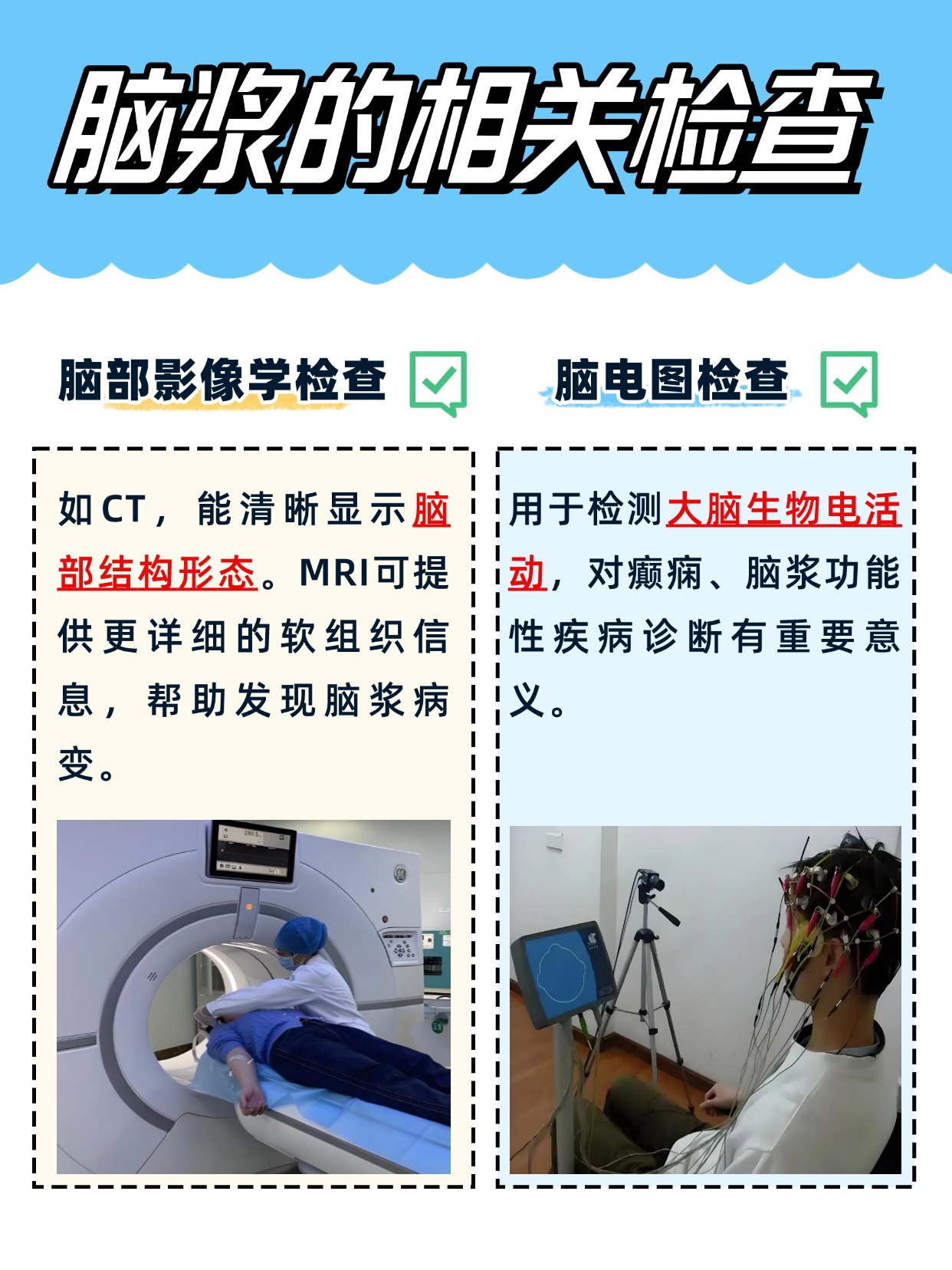 别错认！脑浆是脑脊液吗？可别混为一谈