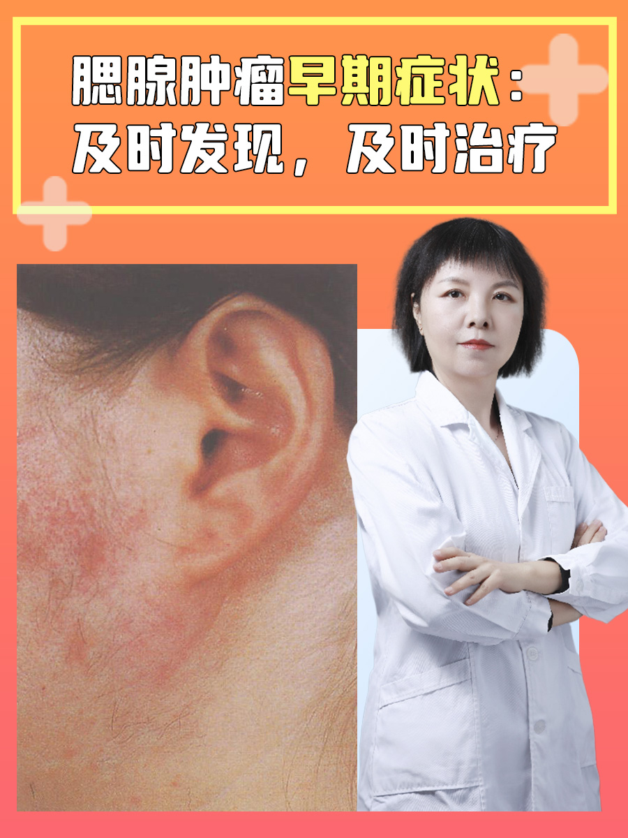 腮腺肿瘤早期症状：及时发现，及时治疗