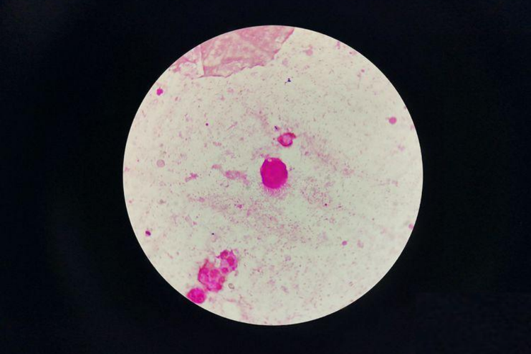 革兰染色滴虫图