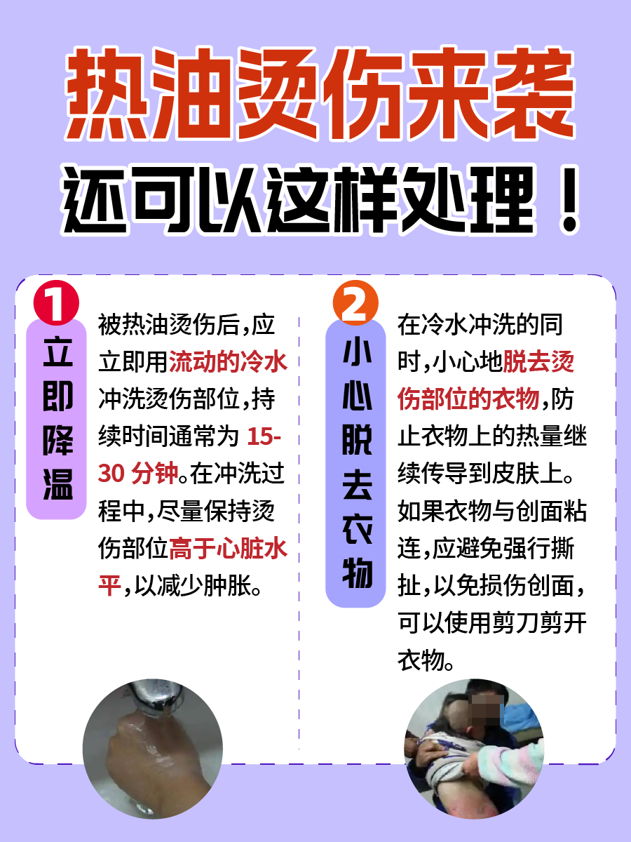 热油烫伤来袭?这药让恢复加速!