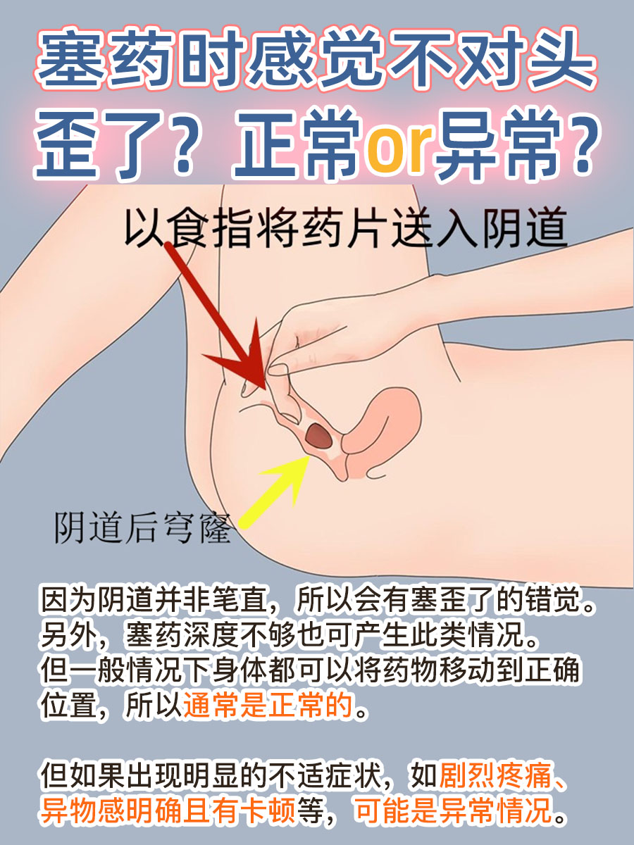 塞药时感觉不对头，歪了？正常or异常？