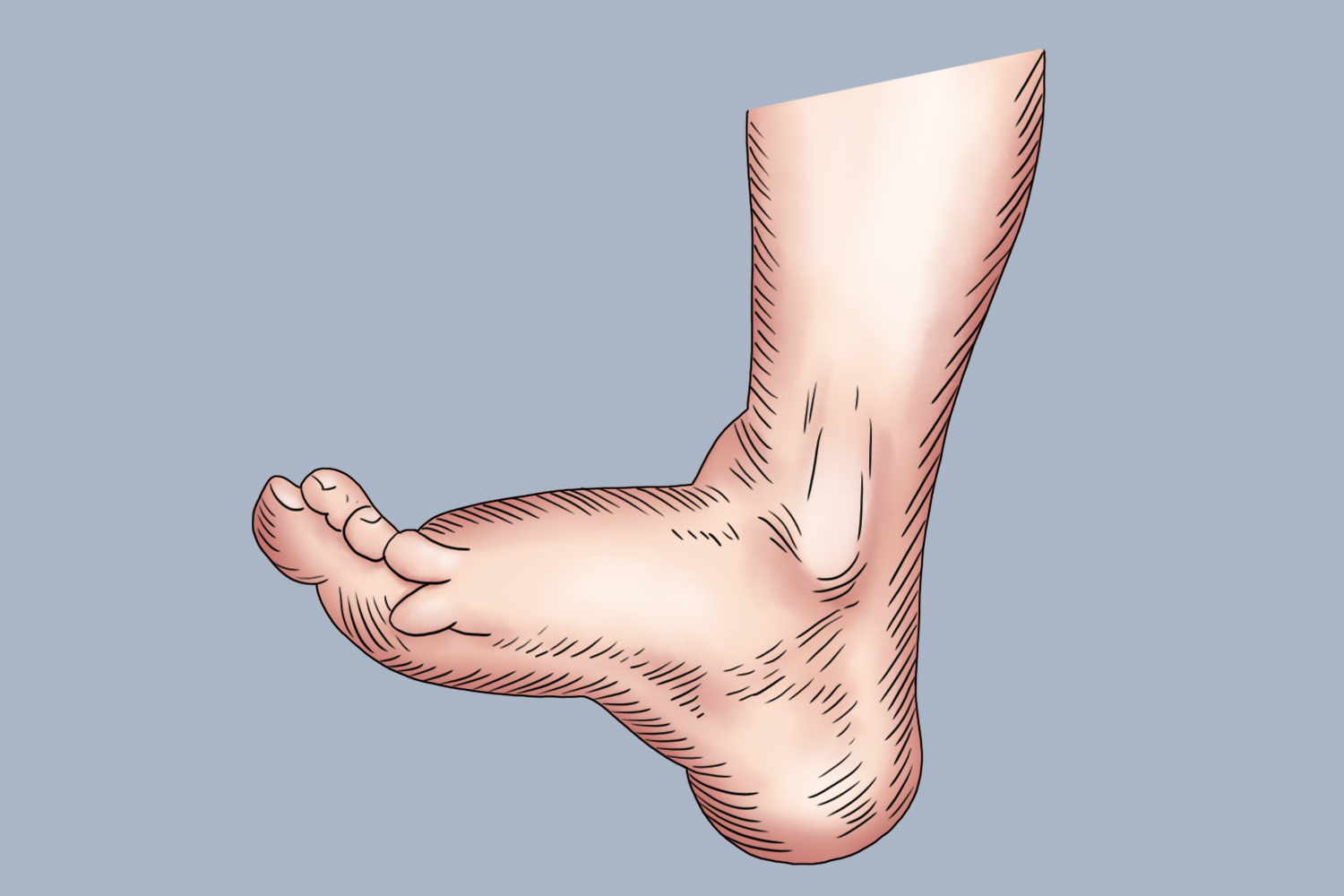 胫神经损伤足部症状图