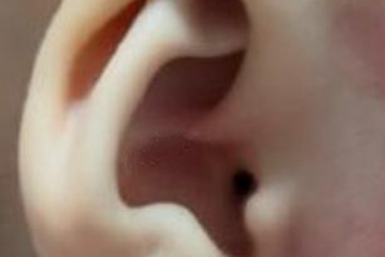 新生儿隐耳图 新生儿隐耳图