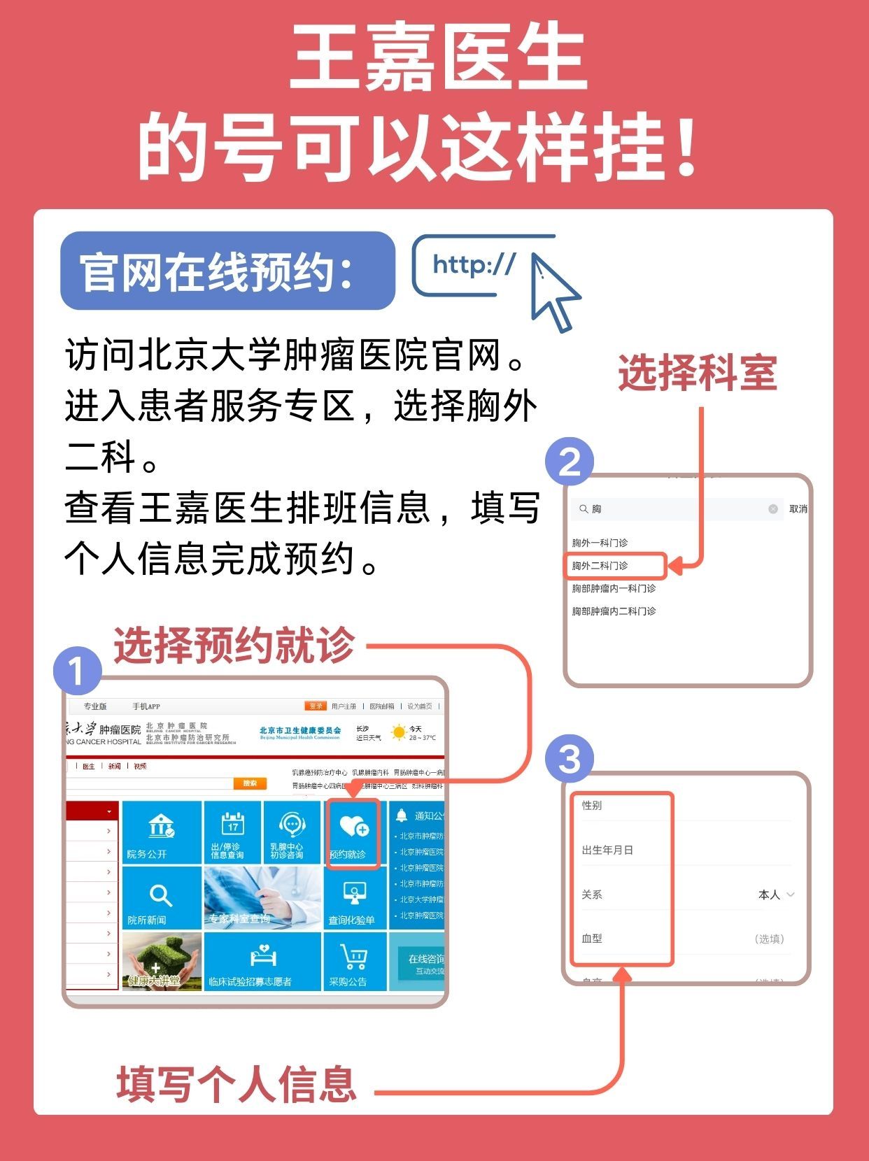 北京肿瘤医院王嘉医生怎么样？怎么挂号？