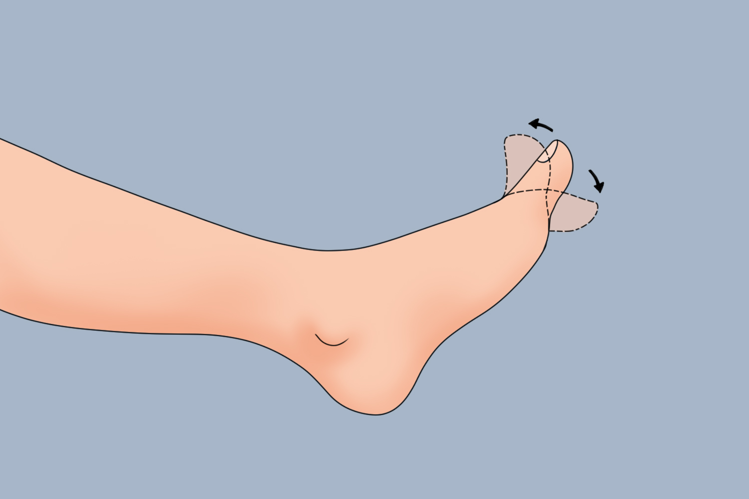 足趾屈伸锻炼图 足趾屈伸锻炼图
