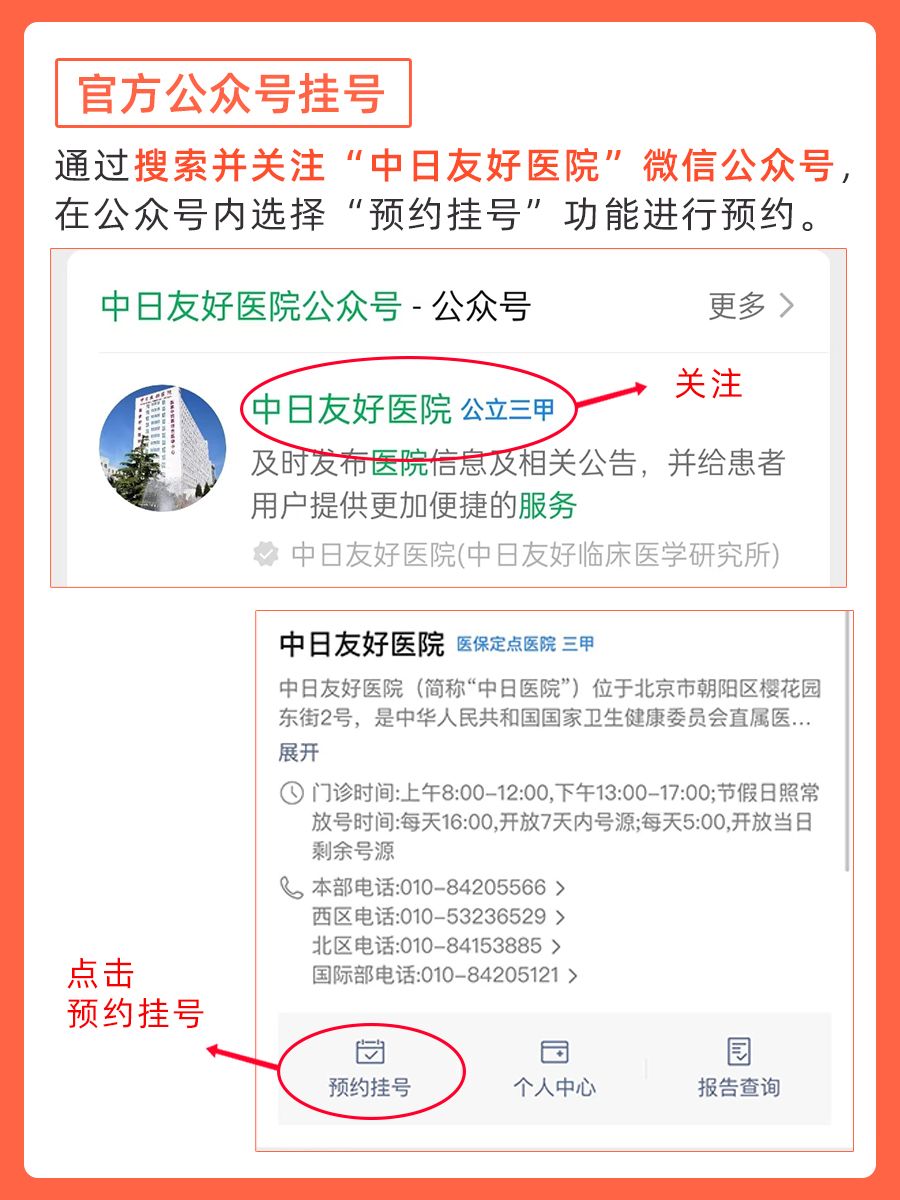 中日友好医院李海聪医生怎么样？怎么挂号？