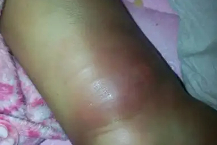 腕关节韧带损伤疼痛部位图