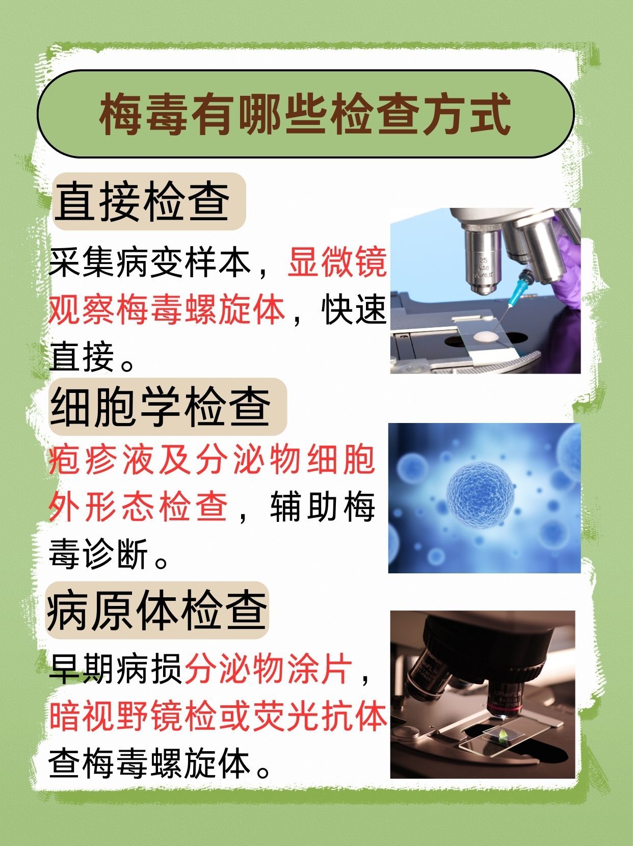 解析：梅毒荧光抗体IgM阴性是什么意思