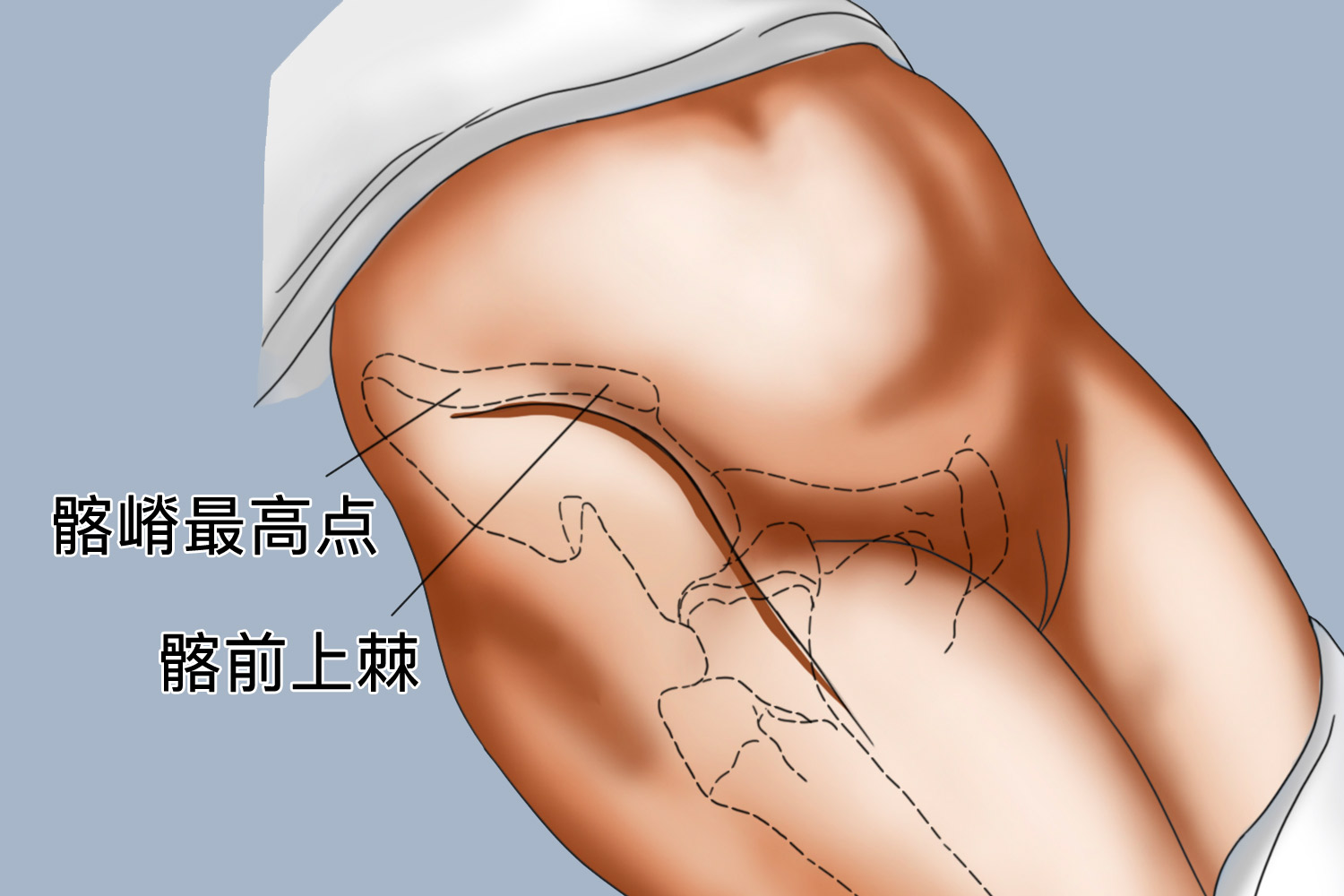 髂嵴最高点寻找真人图图片