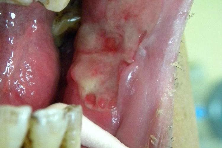 颊癌肿瘤图 颊癌肿瘤图