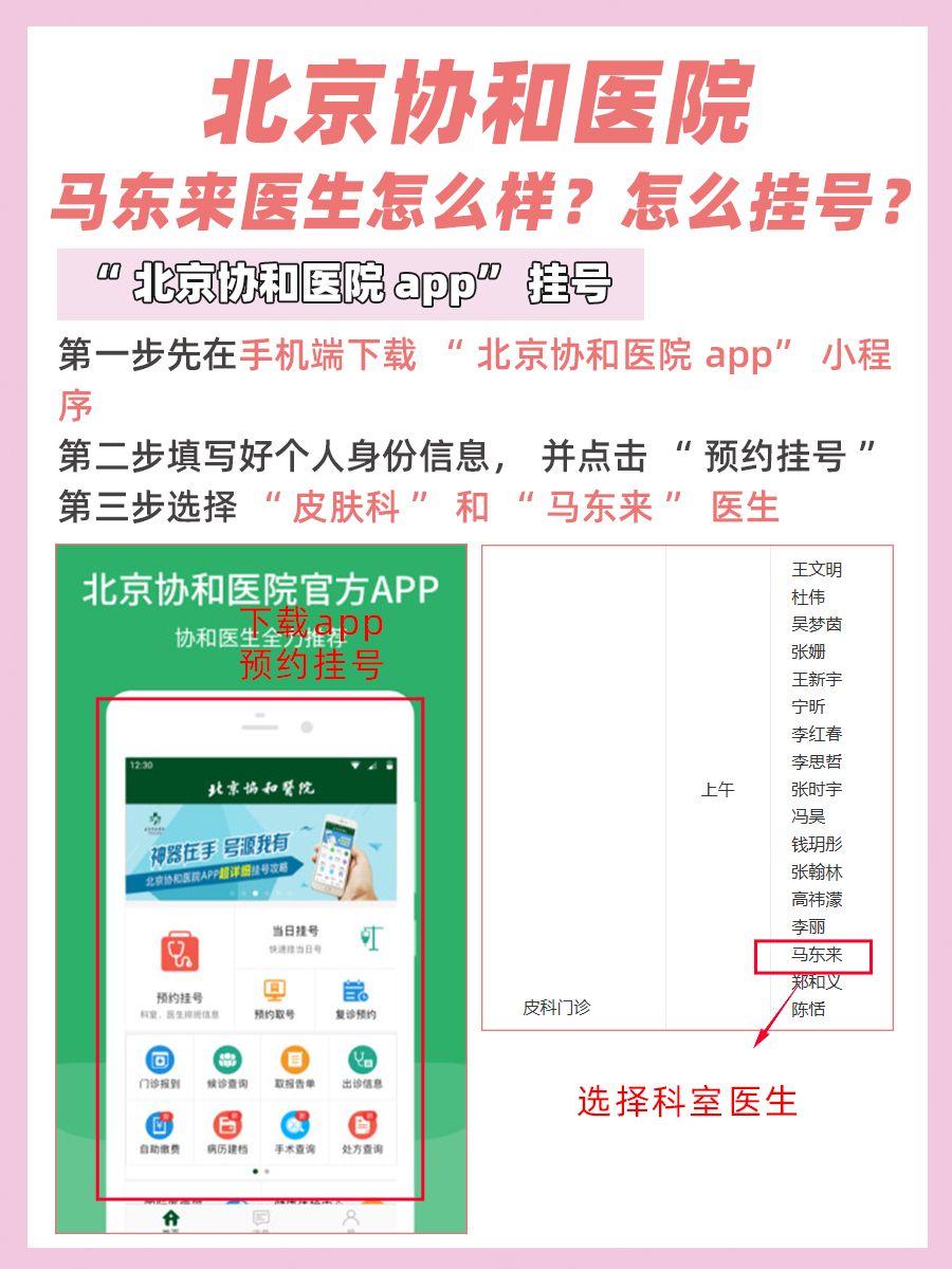 北京协和医院马东来医生怎么样？怎么挂号？