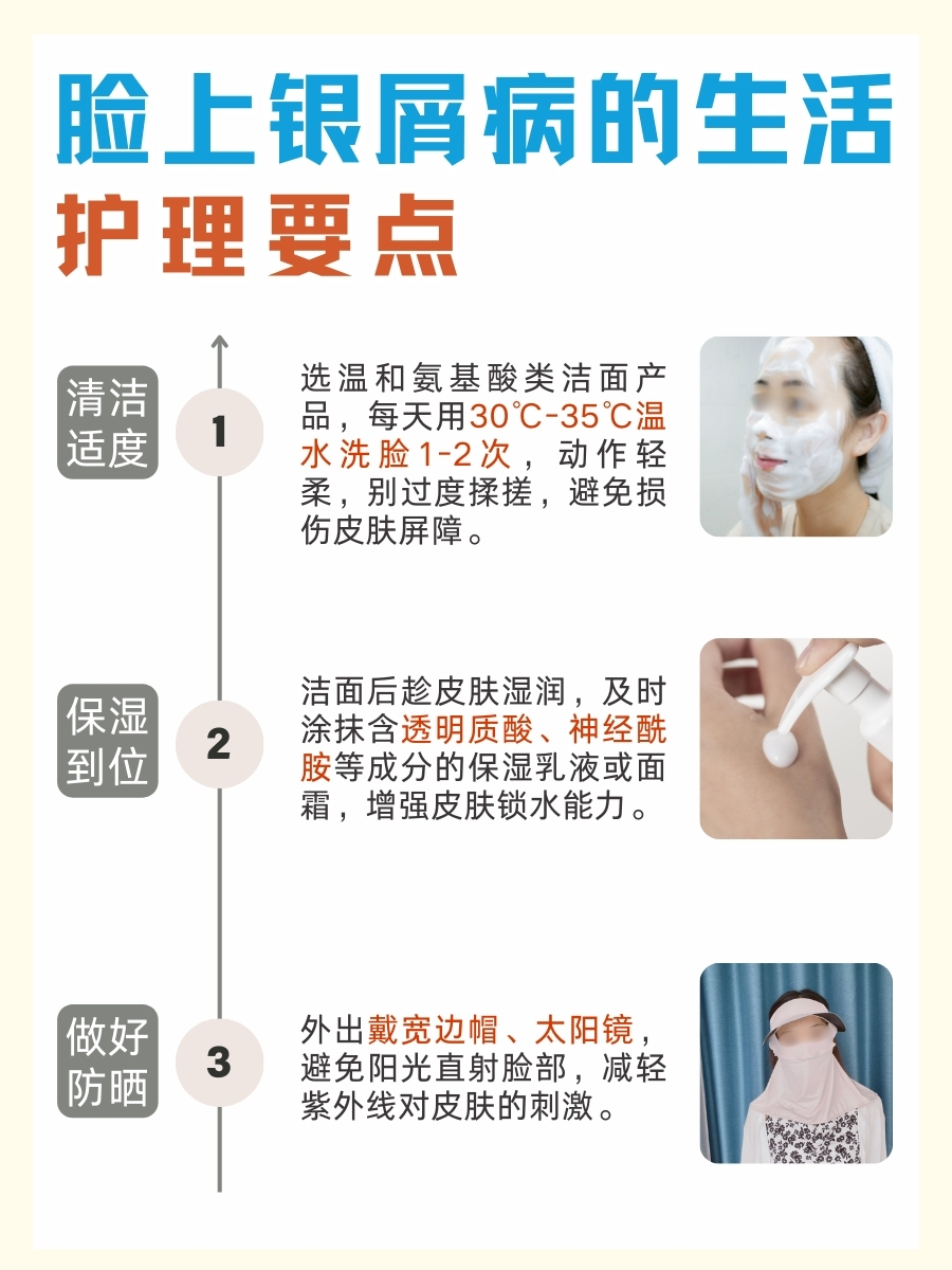 快看!脸银屑病,如何治疗能断根?