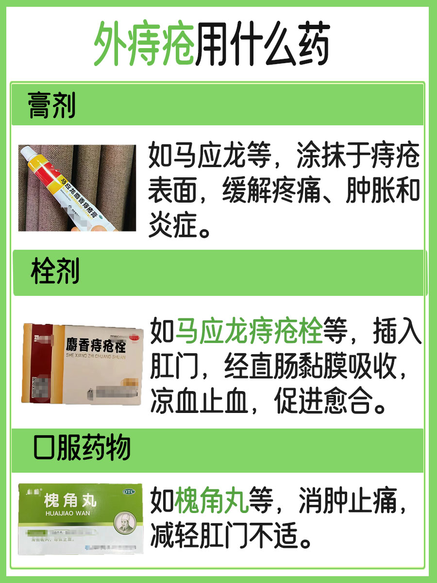 外痔疮用什么药 ，医生解答！