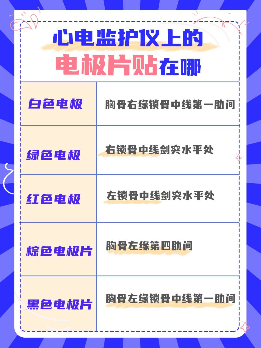 科普！教你秒懂心电监护仪！