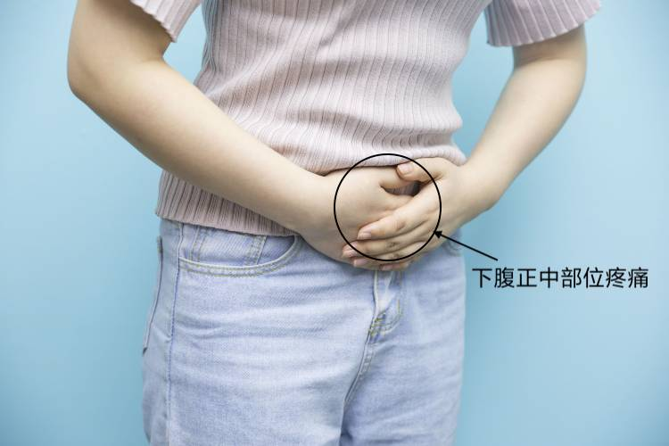 直肠癌腹痛位置图