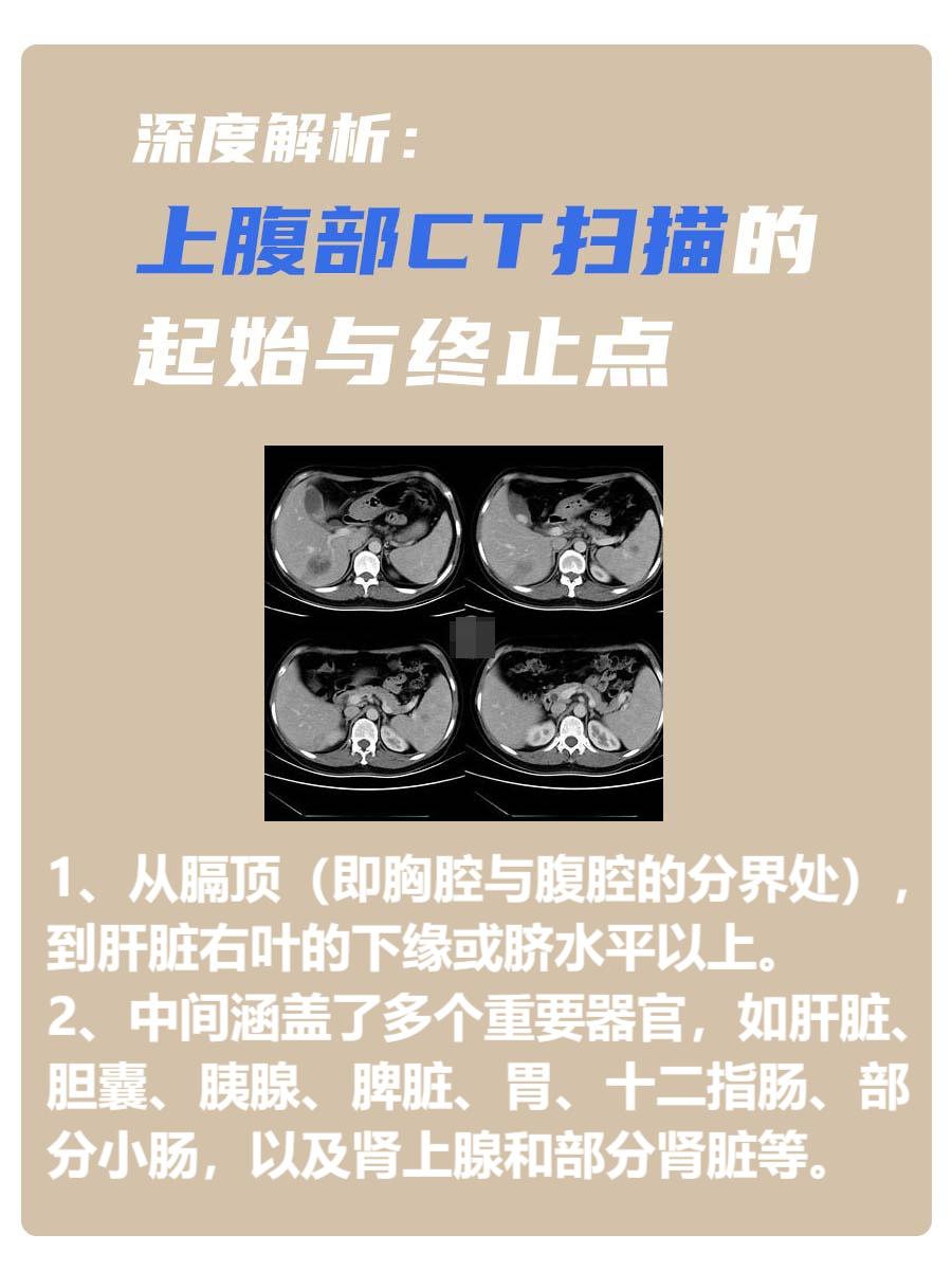 深度解析：上腹部CT扫描的起始与终止点