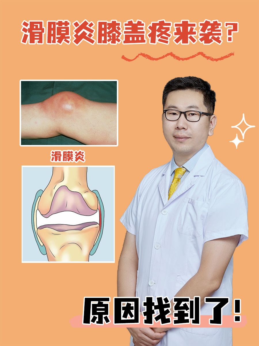 滑膜炎膝盖疼来袭？原因找到了！