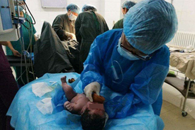 清理新生儿呼吸道图