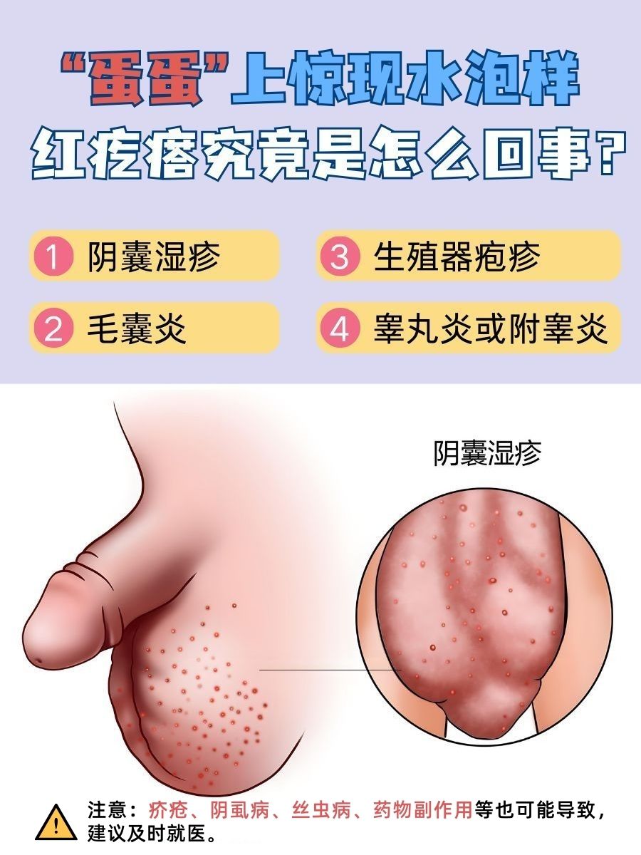 “蛋蛋”上惊现水泡样红疙瘩，究竟是怎么回事？