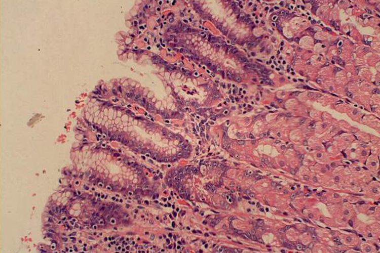 胃的单层柱状上皮图 胃的单层柱状上皮图