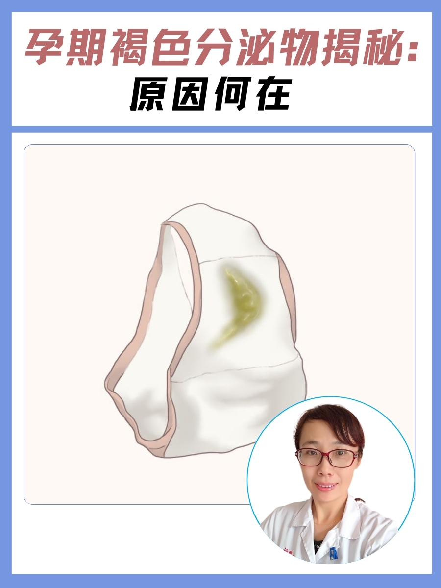 孕期褐色分泌物揭秘：原因何在