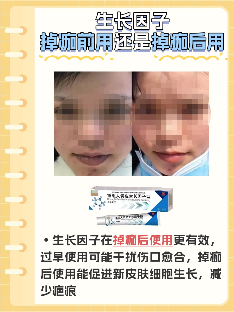 生长因子使用时机：掉痂前后，哪个阶段更适合？