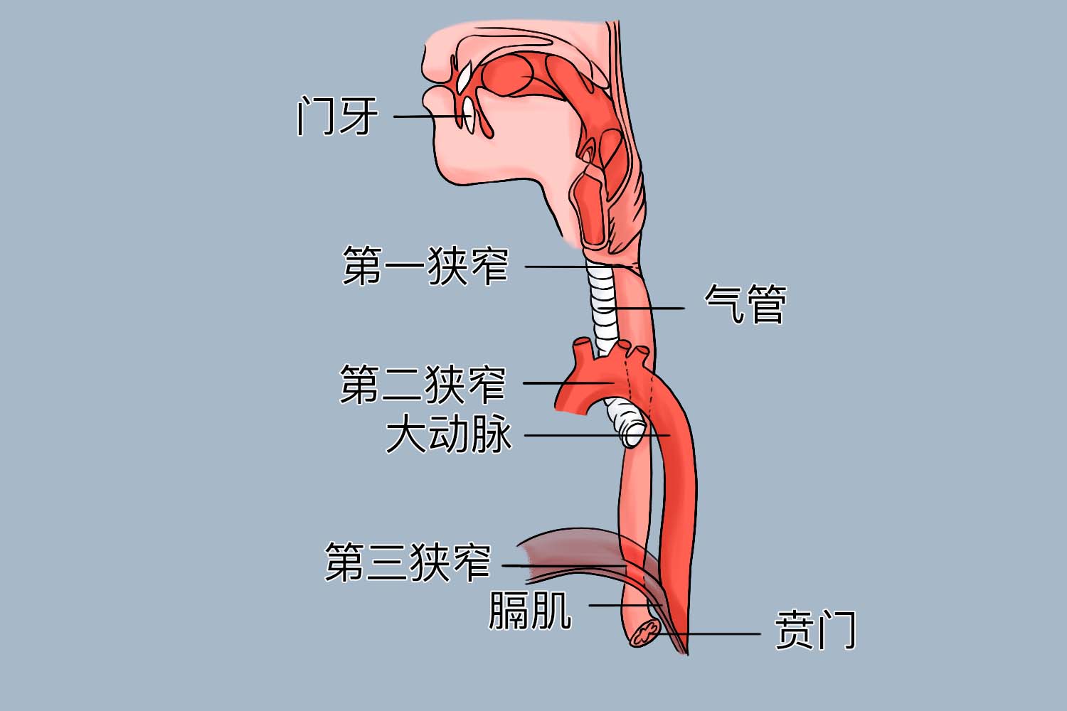 食管距门齿25cm图