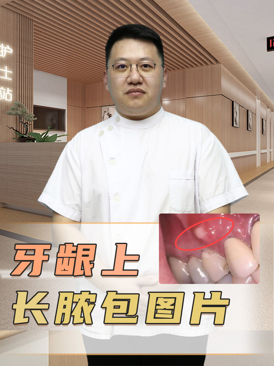 牙龈上长脓包图片