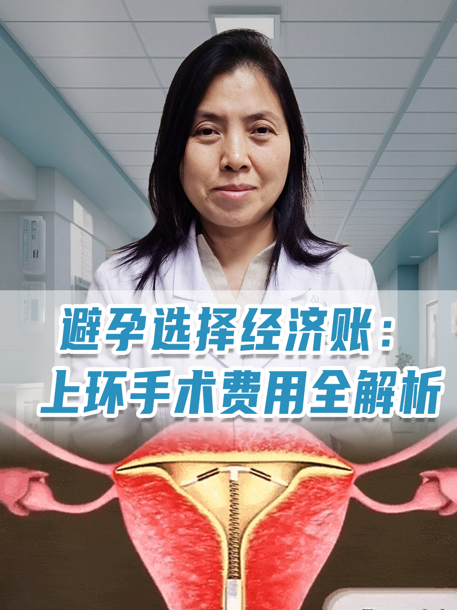 避孕选择经济账：上环手术费用全解析