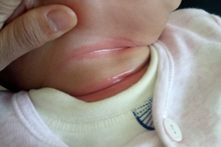 摩擦红斑脖子前面有条形斑图 摩擦红斑脖子前面有条形斑图