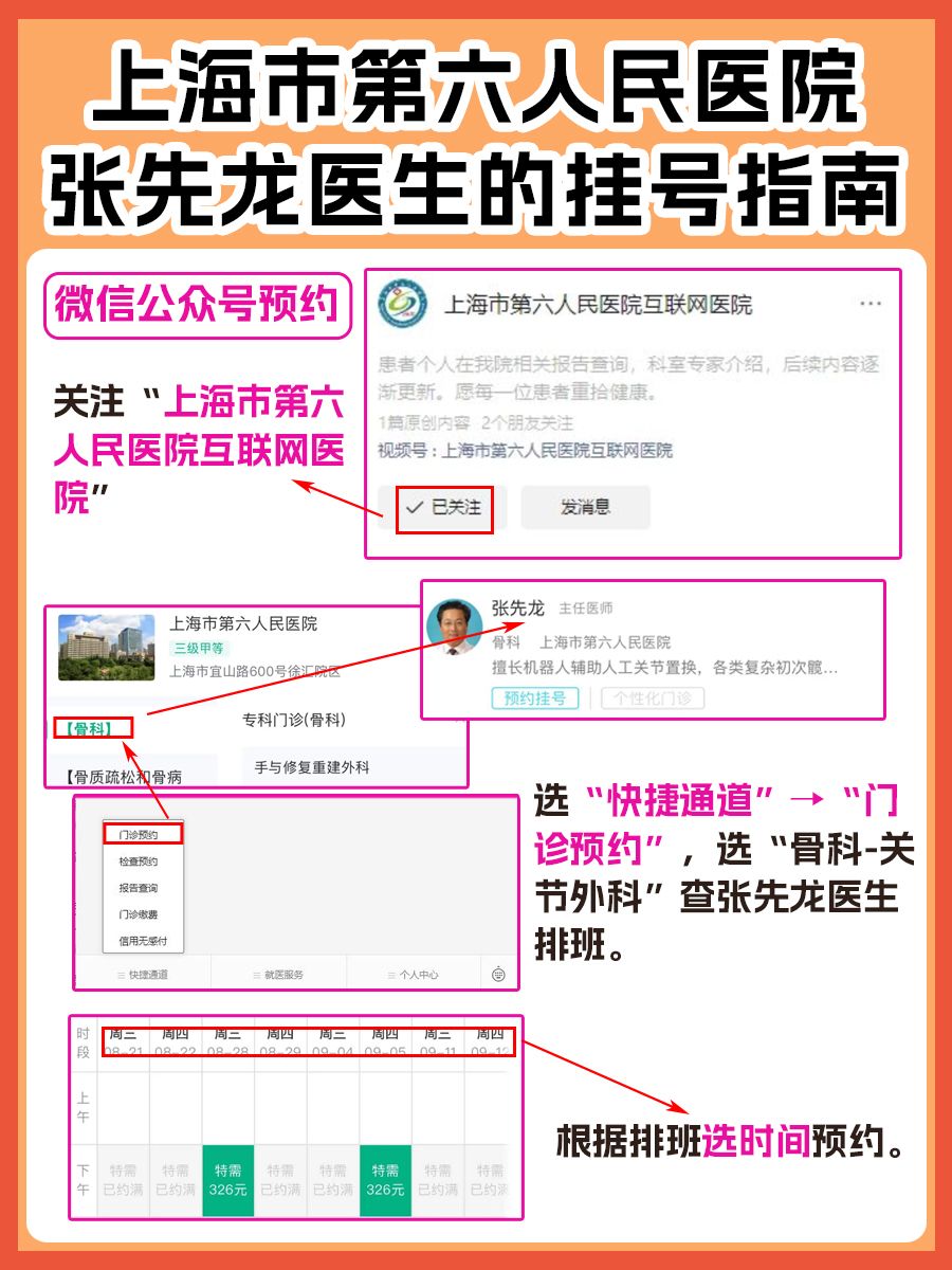 上海市第六人民医院张先龙医生怎么样?怎么挂号?