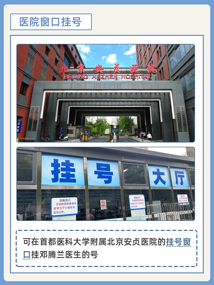 北京安贞医院邓腾兰医生怎么样?怎么挂号?