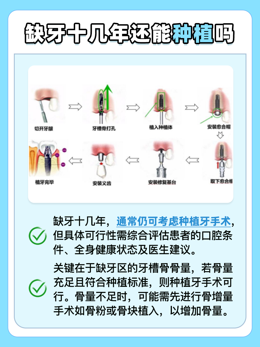 缺牙十几年，种植牙是否依旧可行？