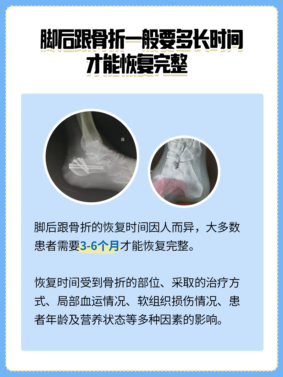 快来看！脚后跟骨折的恢复时间线