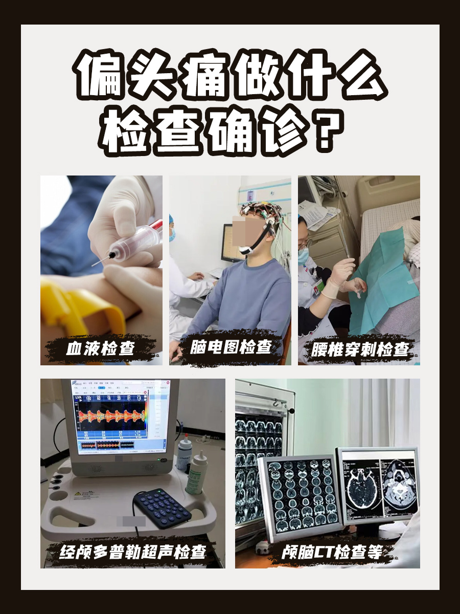 亲身经历:偏头痛10秒止疼法,真的爱了!