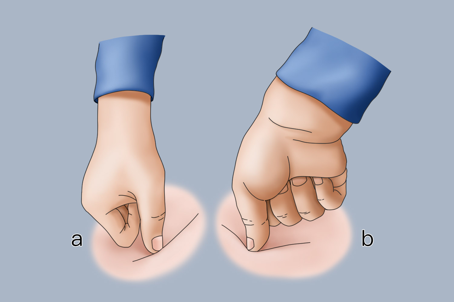 咳嗽止咳的推拿点法图