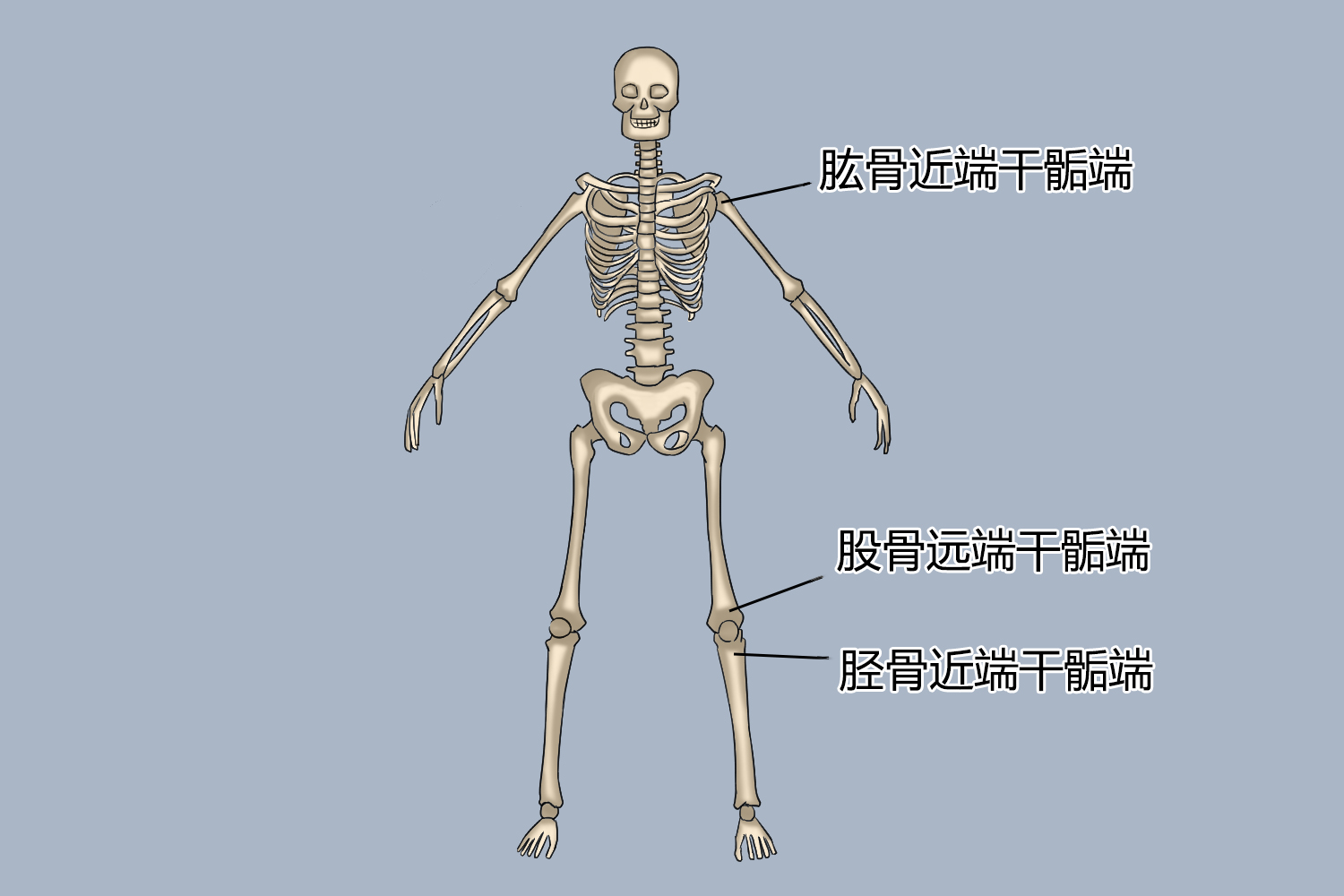 骨肉瘤好发位置图 骨肉瘤好发位置图