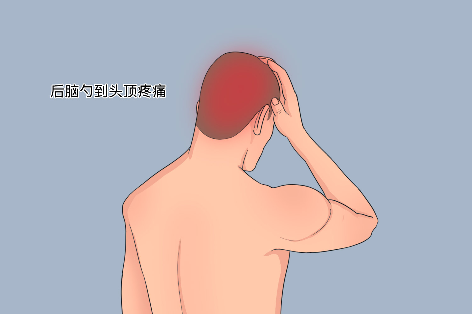 太阳头痛位置图