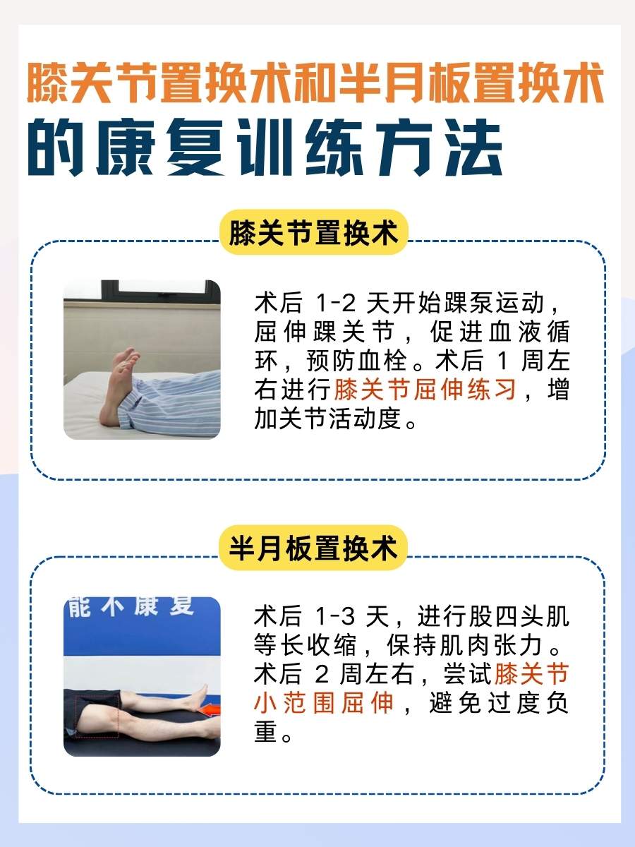 别混淆!膝关节置换和半月板置换不一样